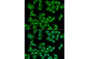Immunofluorescence analysis of A549 cells using ELF3 antibody (ABIN5973778). (ELF3 Antikörper)