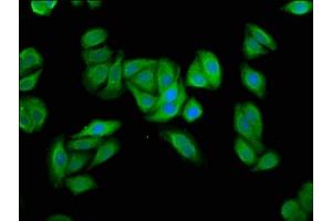 Immunofluorescence staining of HepG2 cells with ABIN7174220 at 1:66, counter-stained with DAPI. (UBIAD1 Antikörper  (AA 1-82))