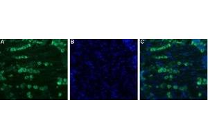 Immunohistochemistry (IHC) image for anti-Sodium Channel, Voltage-Gated, Type XI, alpha Subunit (SCN11A) (AA 1748-1765), (Intracellular) antibody (ABIN7043656)