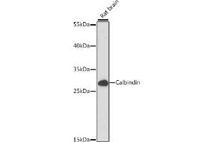 Western blot analysis of extracts of Rat brain, using Calbindin antibody (ABIN7266004) at 1:1000 dilution. (CALB1 Antikörper  (AA 1-261))