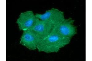 ICC/IF analysis of PGAM2 in Hep3B cells line, stained with DAPI (Blue) for nucleus staining and monoclonal anti-human PGAM2 antibody (1:100) with goat anti-mouse IgG-Alexa fluor 488 conjugate (Green). (PGAM2 Antikörper)