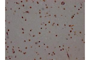 IHC image of ABIN7127324 diluted at 1:100 and staining in paraffin-embedded human brain tissue performed on a Leica BondTM system. (Rekombinanter ADAR Antikörper)