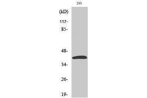 Western Blotting (WB) image for anti-Mitogen-Activated Protein Kinase Kinase 4 (MAP2K4) (Tyr104) antibody (ABIN3175977) (MAP2K4 Antikörper  (Tyr104))