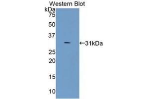 Western blot analysis of recombinant Human COL4a5. (COL4a5 Antikörper)