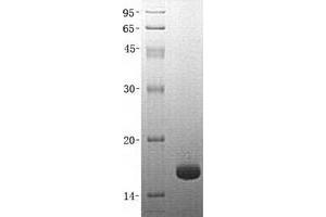 Western Blotting (WB) image for Fatty Acid Binding Protein 5 (Psoriasis-Associated) (FABP5) protein (GST tag) (ABIN2720669)