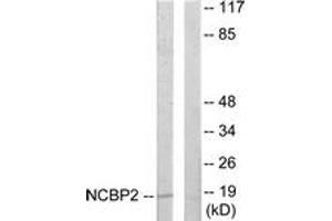Western blot analysis of extracts from COLO205 cells, using NCBP2 Antibody. (NCBP2 Antikörper  (AA 10-59))