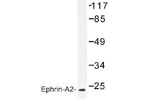 Image no. 1 for anti-Ephrin A2 (EFNA2) antibody (ABIN272138) (Ephrin A2 Antikörper)