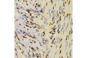 Immunohistochemistry (Paraffin-embedded Sections) (IHC (p)) image for anti-X-Ray Repair Complementing Defective Repair in Chinese Hamster Cells 5 (Double-Strand-Break Rejoining) (XRCC5) (AA 543-732) antibody (ABIN6150309)