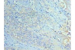Immunohistochemistry (IHC) image for anti-Eukaryotic Translation Initiation Factor 2 alpha Kinase 4 (EIF2AK4) (AA 1-300) antibody (ABIN7151465)