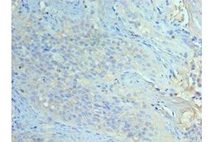 Immunohistochemistry of paraffin-embedded human tonsil tissue using ABIN7151465 at dilution of 1:100 (GCN2 Antikörper  (AA 1-300))