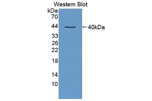 Western blot analysis of the recombinant protein. (CCL3 Antikörper  (AA 27-92))