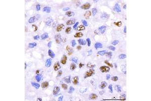 IHC analysis of CRTC3 using anti-CRTC3 antibody (ABIN7599779). (CRTC3 Antikörper  (AA 116-619))