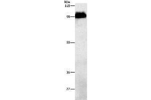 Western Blot analysis of Mouse brain tissue using beta Amyloid Polyclonal Antibody at dilution of 1:1000 (beta Amyloid Antikörper)