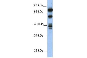 STRBP antibody used at 1 ug/ml to detect target protein. (STRBP Antikörper  (Middle Region))