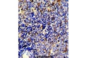Immunohistochemistry (IHC) image for anti-C-Mer Proto-Oncogene Tyrosine Kinase (MERTK) antibody (ABIN3003537) (MERTK Antikörper)