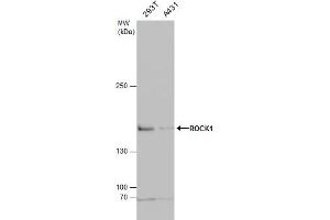 Western Blotting (WB) image for anti-rho-Associated, Coiled-Coil Containing Protein Kinase 1 (ROCK1) (N-Term) antibody (ABIN2856887)