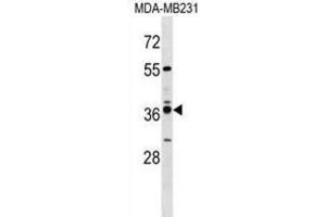 Western Blotting (WB) image for anti-Vomeronasal 1 Receptor 4 (VN1R4) antibody (ABIN3000072) (VN1R4 Antikörper)