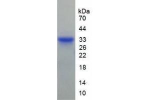 SDS-PAGE analysis of Human Matrix Metalloproteinase 7 (MMP7) Protein.