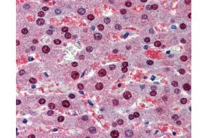 BMPER antibody was used for immunohistochemistry at a concentration of 4-8 ug/ml. (BMPER Antikörper  (C-Term))