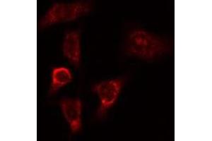 ABIN6275266 staining HeLa cells by IF/ICC. (MYO9B Antikörper  (N-Term))