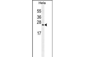TI Antibody (Center) (ABIN654107 and ABIN2843990) western blot analysis in Hela cell line lysates (35 μg/lane). (TIMP4 Antikörper  (AA 48-74))
