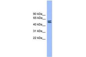 Image no. 1 for anti-serine Peptidase Inhibitor, Kunitz Type 1 (SPINT1) (AA 421-470) antibody (ABIN6745334) (SPINT1 Antikörper  (AA 421-470))