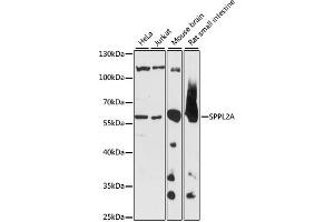 Western blot analysis of extracts of various cell lines, using SPPL2A antibody (ABIN7270297) at 1:1000 dilution. (SPPL2A Antikörper  (AA 421-520))