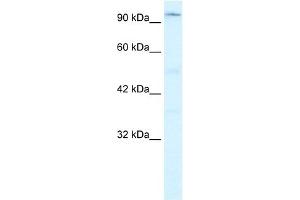 WB Suggested Anti-ZNF409 Antibody Titration:  0. (ZFHX2 Antikörper  (Middle Region))