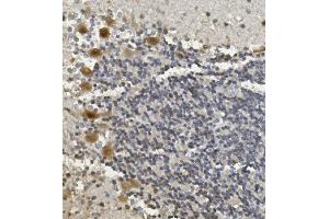 IHC analysis of Rad9b using anti-Rad9b antibody (ABIN7599360). (RAD9B Antikörper  (AA 1-403))