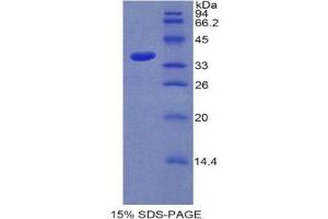 SDS-PAGE (SDS) image for Sulfotransferase Family, Cytosolic, 1A, Phenol-Preferring, Member 1 (SULT1A1) (AA 3-291) protein (His tag) (ABIN1878148)