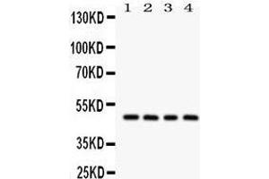 Western Blotting (WB) image for anti-serpin Peptidase Inhibitor, Clade A (Alpha-1 Antiproteinase, Antitrypsin), Member 1 (SERPINA1) (AA 211-411) antibody (ABIN3043431) (SERPINA1 Antikörper  (AA 211-411))