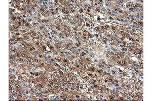 Image no. 8 for anti-Aminoacylase 1 (ACY1) antibody (ABIN1496454) (Aminoacylase 1 Antikörper)