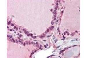 Immunohistochemistry (IHC) image for anti-PAP Associated Domain Containing 7 (PAPD7) (AA 447-462) antibody (ABIN2470063) (PAP Associated Domain Containing 7 (PAPD7) (AA 447-462) Antikörper)