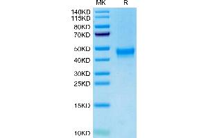 Cynomolgus/Rhesus macaque DKK1 Tris-Bis PAGE under reduced condition. (DKK1 Protein (AA 32-266) (His tag))
