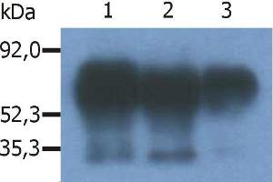 Immunoprecipitation of human PAG/Cbp from the lysate of RAJI human Burkitt lymphoma cell line. (PAG1 Antikörper  (C-Term))