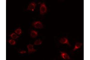 ABIN6275973 staining Hela by IF/ICC. (BAI1 Antikörper  (Internal Region))