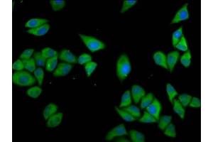 Immunofluorescence staining of Hela cells with ABIN7147569 at 1:133, counter-stained with DAPI. (CLCC1 Antikörper  (AA 446-551))