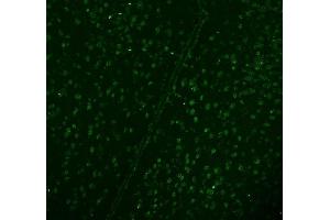 IF analysis of DDX1 using anti-DDX1 antibody (ABIN7602052).