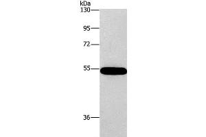 Western Blot analysis of 293T cell using CNDP1 Polyclonal Antibody at dilution of 1:320