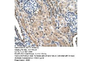 Human kidney (FLJ22167 (N-Term) Antikörper)