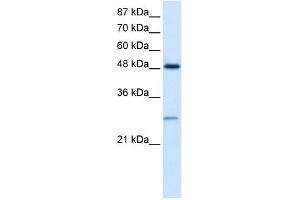 WB Suggested Anti-CLIC4 Antibody Titration:  2. (CLIC4 Antikörper  (N-Term))