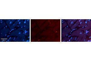 Rabbit Anti-RING1 Antibody Catalog Number: ARP33227_P050 Formalin Fixed Paraffin Embedded Tissue: Human heart Tissue Observed Staining: Nucleus Primary Antibody Concentration: 1:100 Other Working Concentrations: 1:600 Secondary Antibody: Donkey anti-Rabbit-Cy3 Secondary Antibody Concentration: 1:200 Magnification: 20X Exposure Time: 0. (RING1 Antikörper  (Middle Region))
