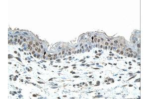 Immunohistochemistry (IHC) image for anti-SMAD, Mothers Against DPP Homolog 1 (SMAD1) (N-Term) antibody (ABIN2780719) (SMAD1 Antikörper  (N-Term))