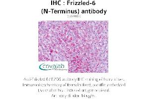 Image no. 2 for anti-Frizzled Family Receptor 6 (FZD6) (Extracellular Domain), (N-Term) antibody (ABIN1734469) (FZD6 Antikörper  (Extracellular Domain, N-Term))