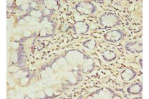 Immunohistochemistry of paraffin-embedded human small intestine tissue using ABIN7173373 at dilution of 1:100 (TCHP Antikörper  (AA 1-498))
