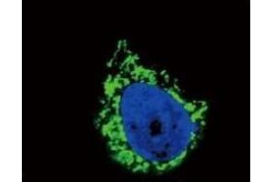 Immunofluorescence (IF) image for anti-Insulin-Like Growth Factor Binding Protein 2, 36kDa (IGFBP2) (AA 277-305) antibody (ABIN3031351)