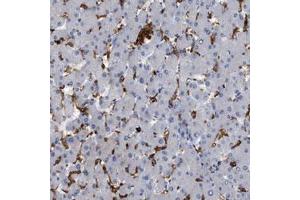 Immunohistochemical staining (Formalin-fixed paraffin-embedded sections) of human liver shows strong cytoplasmic positivity in Kupffer cells with CD300A polyclonal antibody  at 1:20 - 1:50 dilution. (CD300a Antikörper  (AA 98-149))