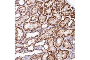 Immunohistochemical staining of human kidney with BCO2 polyclonal antibody  shows strong cytoplasmic positivity in renal tubules at 1:50-1:200 dilution. (BCO2 Antikörper)
