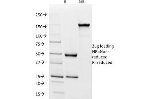 SDS-PAGE Analysis Purified IgD Mouse Monoclonal Antibody (IGD26). (IgD Antikörper)