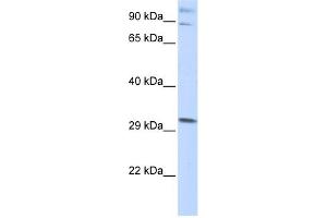 WB Suggested Anti-ZNF148 Antibody Titration:  0. (ZNF148 Antikörper  (Middle Region))
